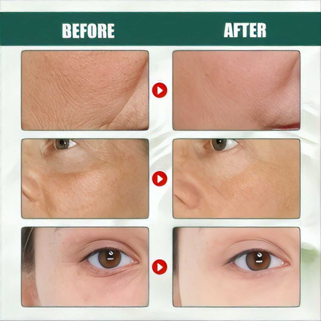 Serum De Aguacate Anti Arrugas