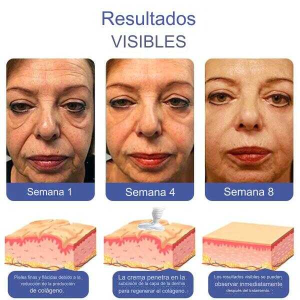 Serum De Aguacate Anti Arrugas