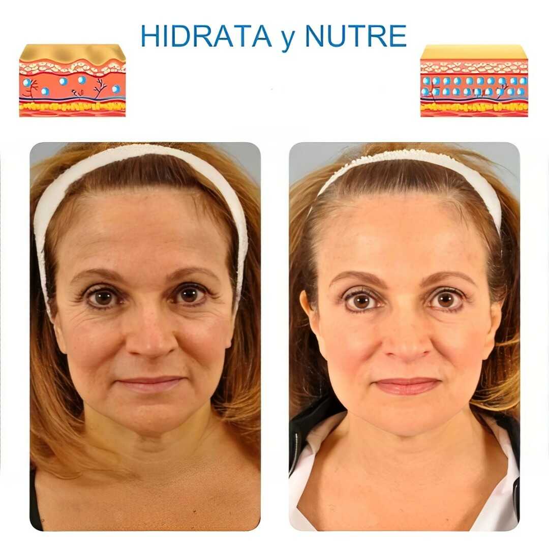 Serum De Aguacate Anti Arrugas