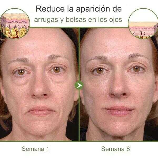Serum De Aguacate Anti Arrugas